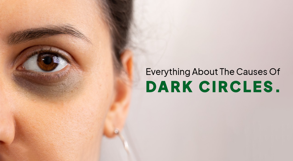 Everything About The Causes Of Dark Circles