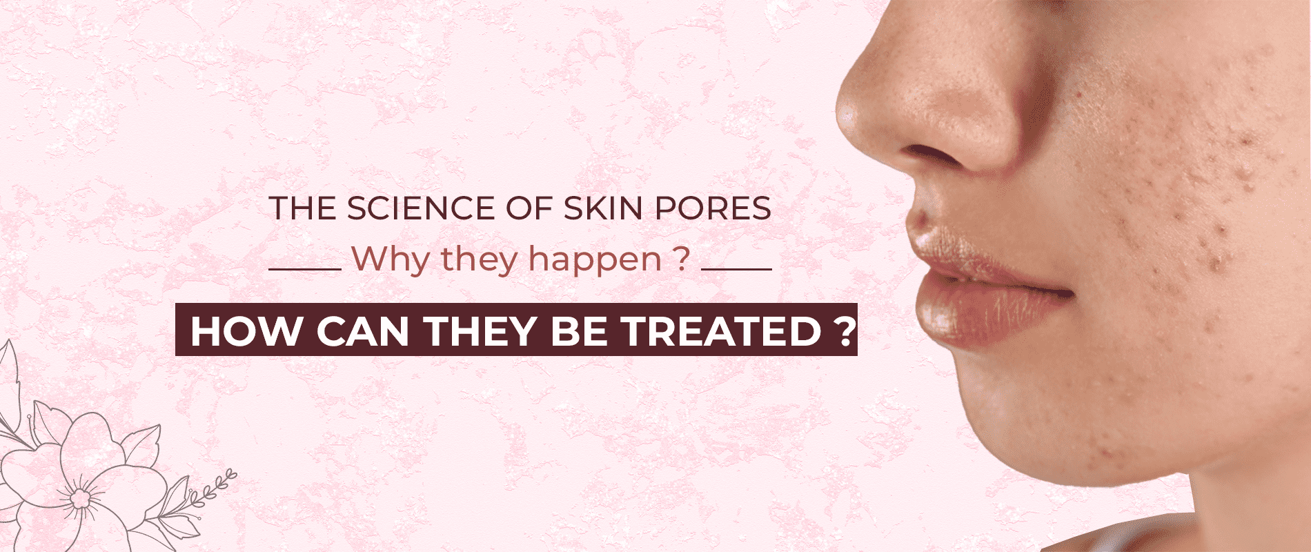 The Science of Skin Pores: Why they happen & how can they be treated?