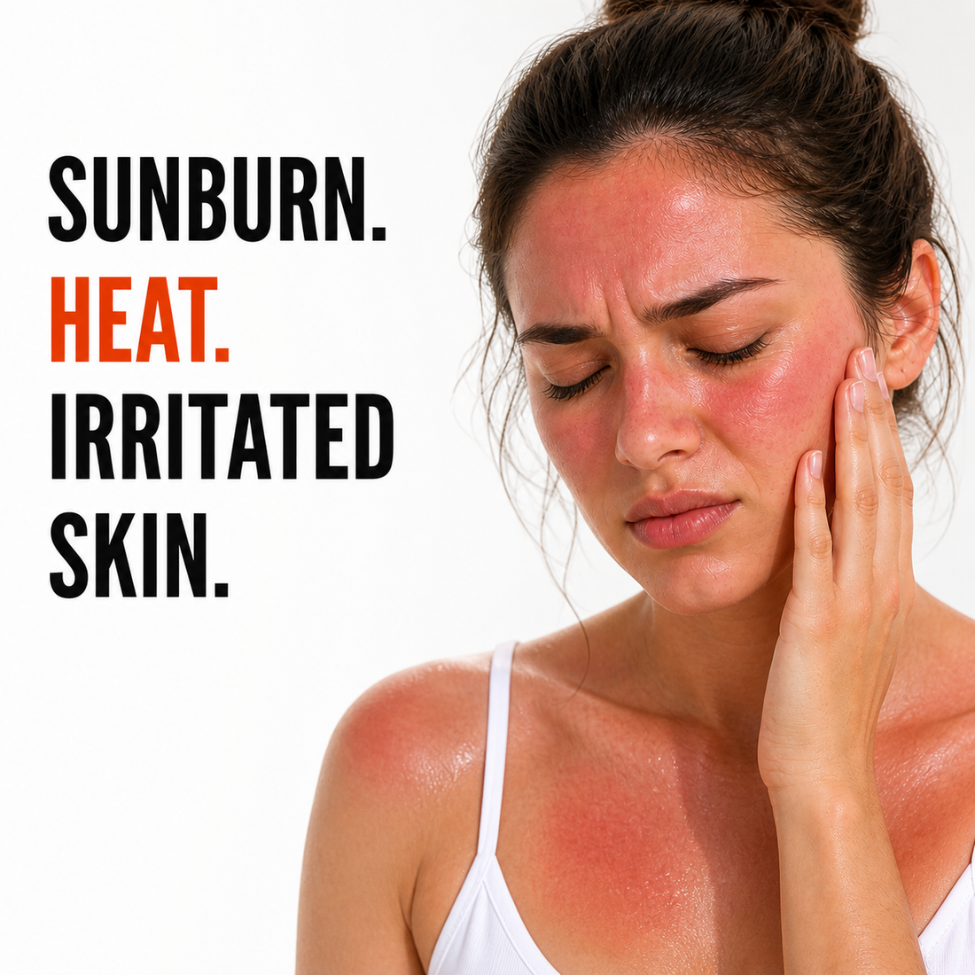 Anherb Natural After Sun Recovery Gel, UV - A &amp; UV - B Protection | Paraben Free Formulation| All Skin Types|100 ml